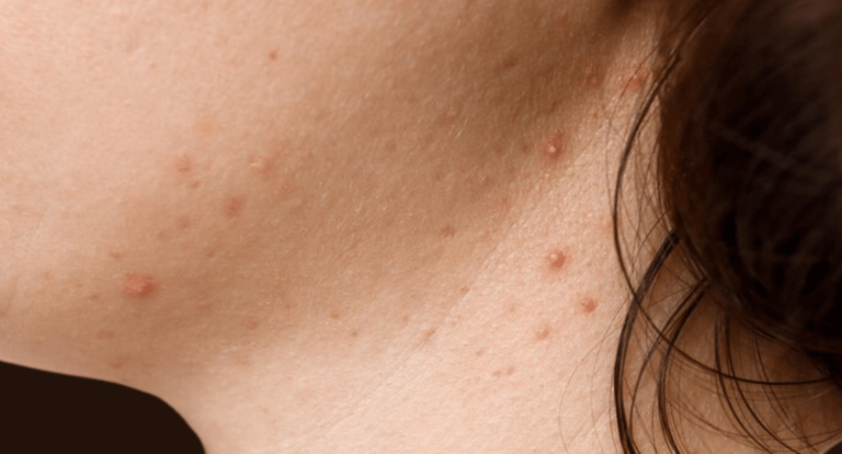 Do you have these red spots on different parts of your body