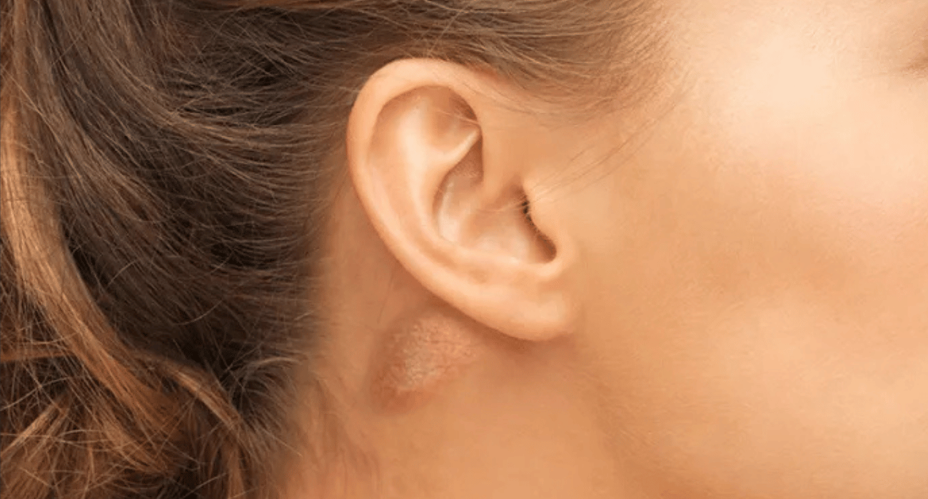 Do you have that bump on your neck… your back… or behind your ear? That’s what that means!