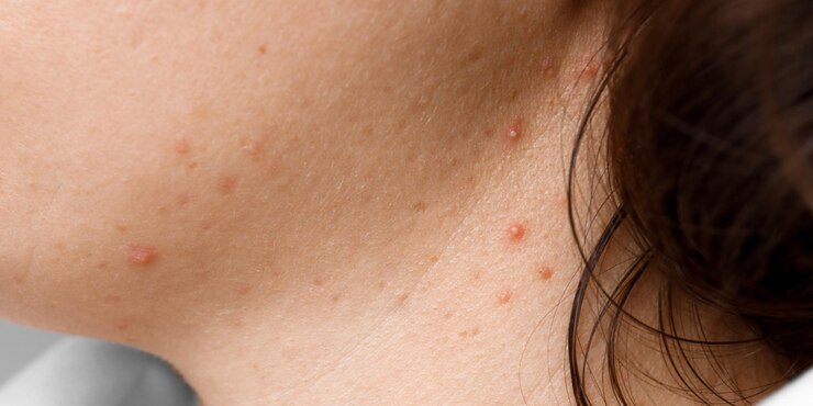 Do you have these red spots on different parts of your body