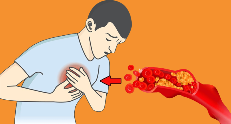 Here Are 7 Warning Signs You Have Blocked Arteries